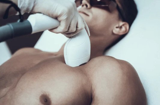 ジュノビューティークリニックのメンズ脱毛の口コミ